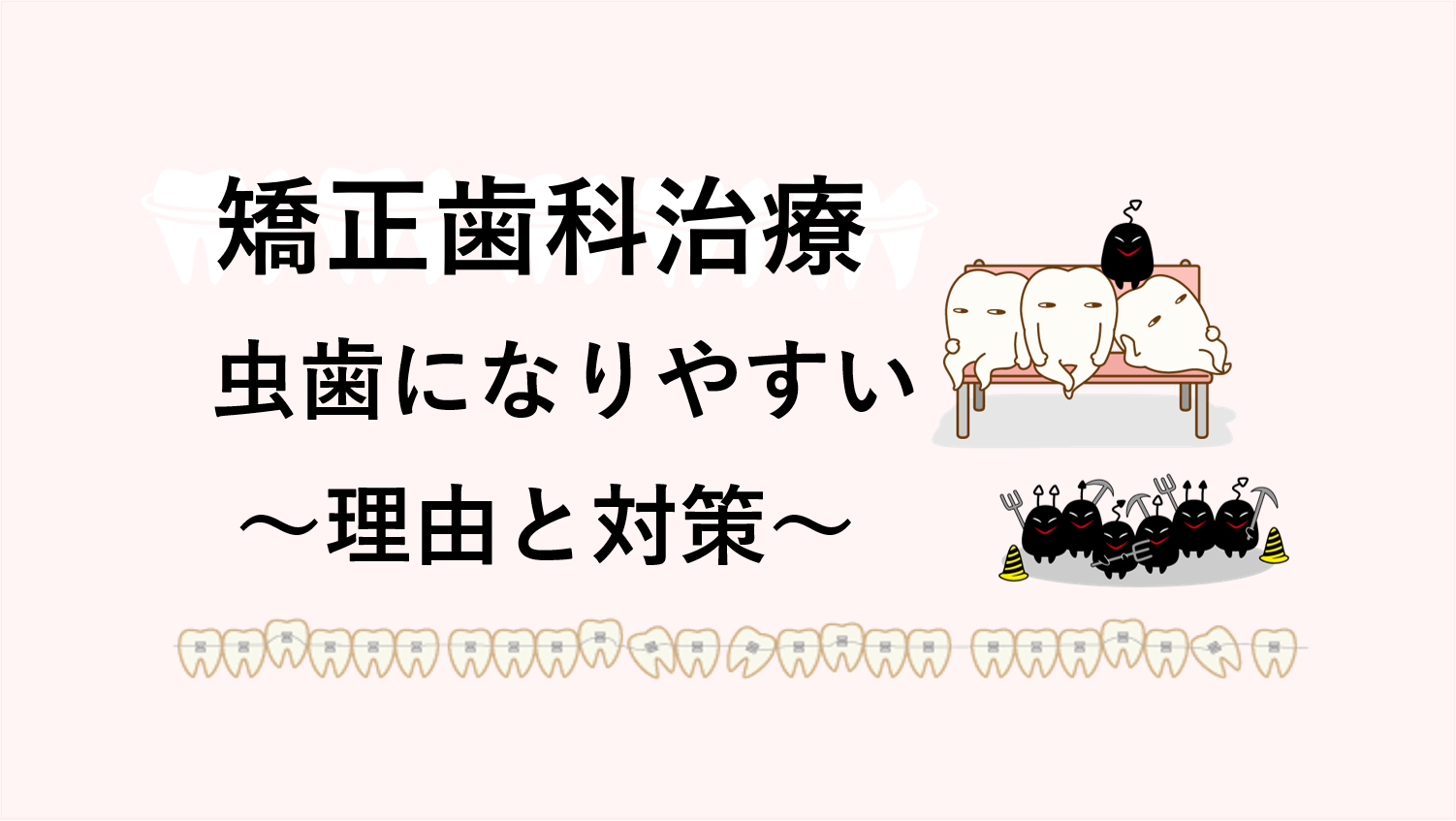 矯正歯科治療中は虫歯になりやすい～理由と対策～