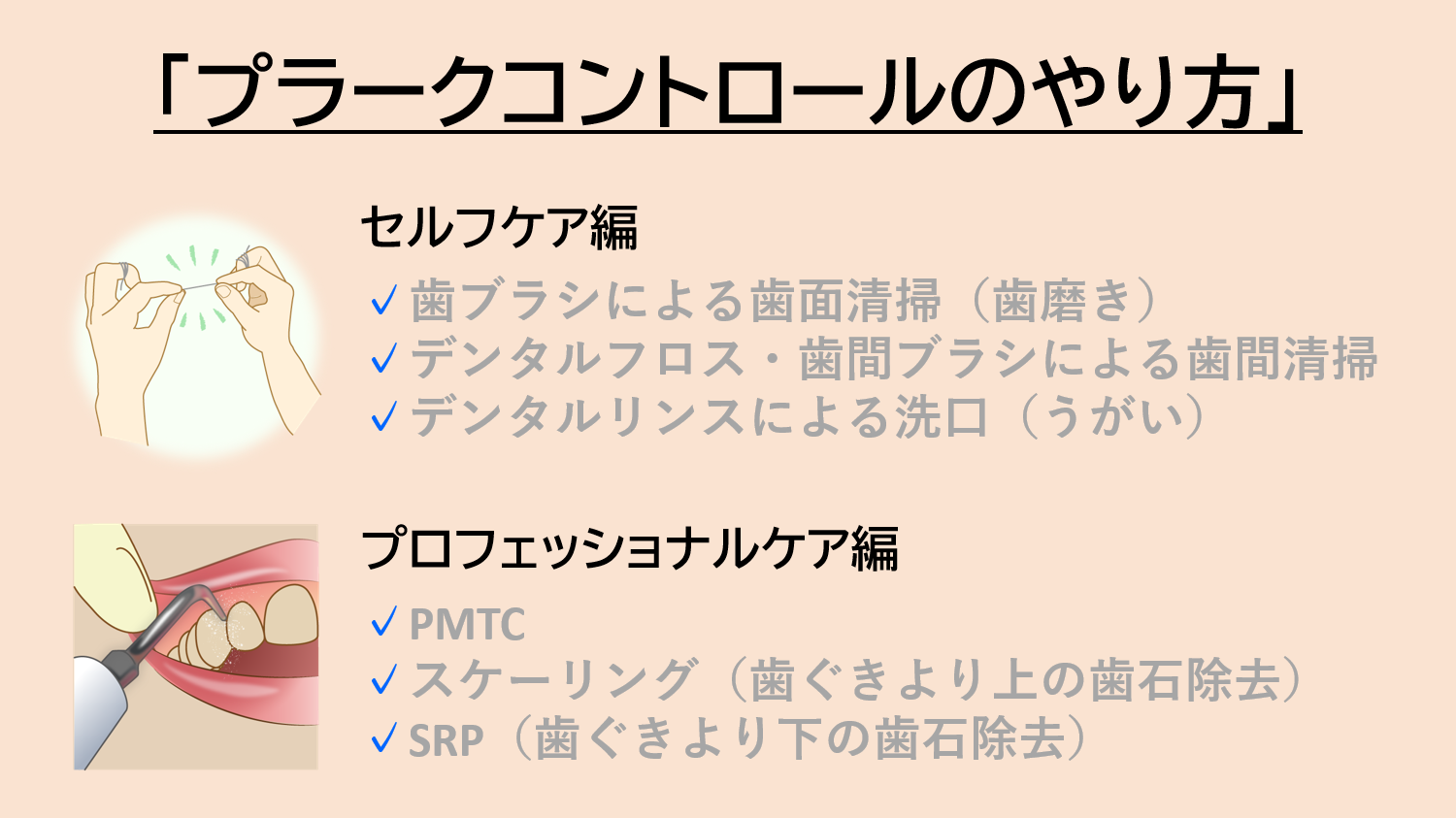 プラークコントロールのやり方