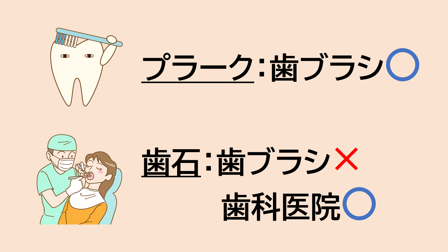 “プラーク（歯垢）”と“歯石”の違い
