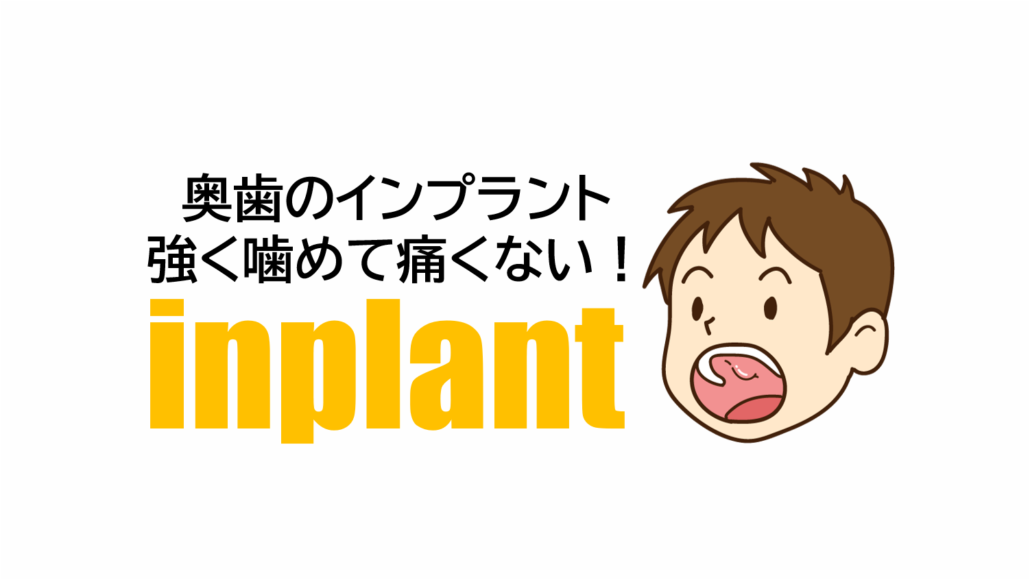 奥歯をインプラントにすると強く噛めて痛くない！
