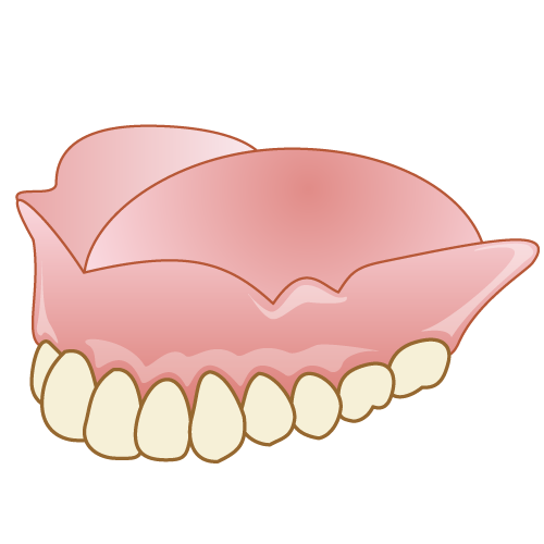 有床義歯（入れ歯）