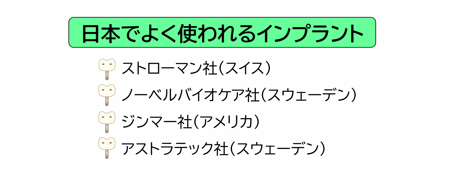 日本でよく使われるインプラントの種類