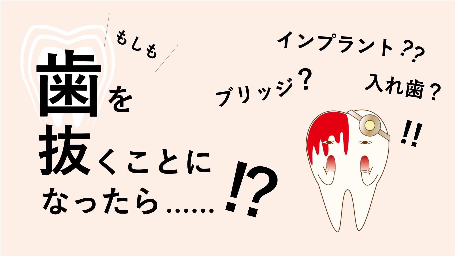 歯を抜くことになった場合の選択