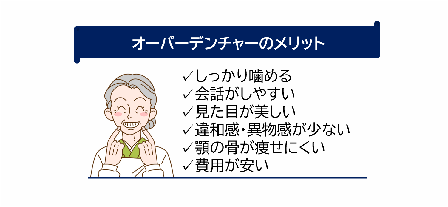 オーバーデンチャーのメリット