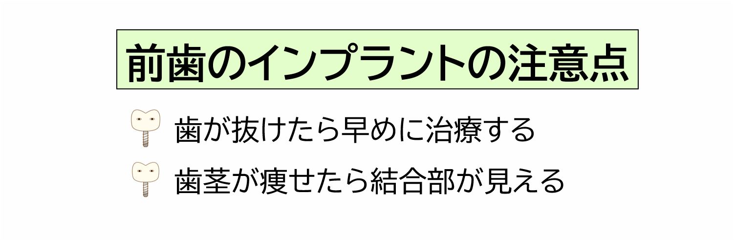 前歯のインプラントの注意点