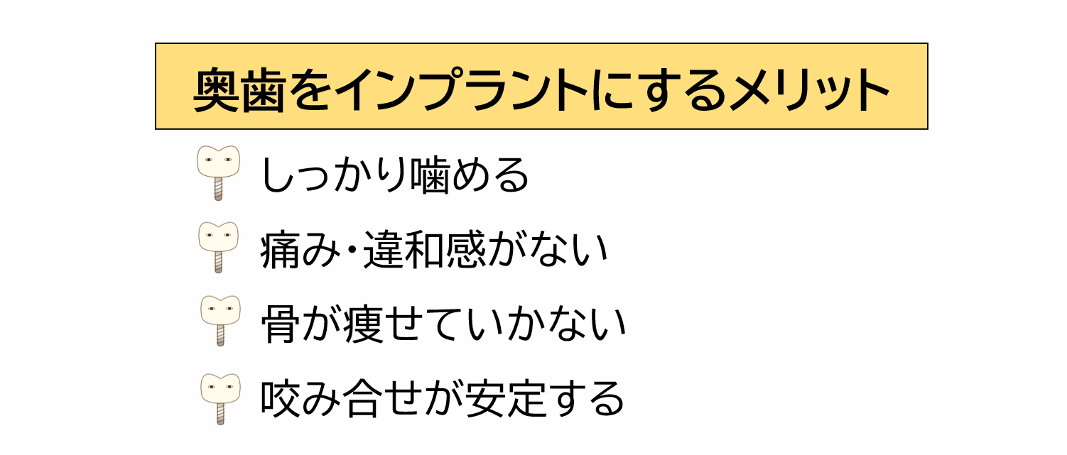 奥歯をインプラントにするメリット