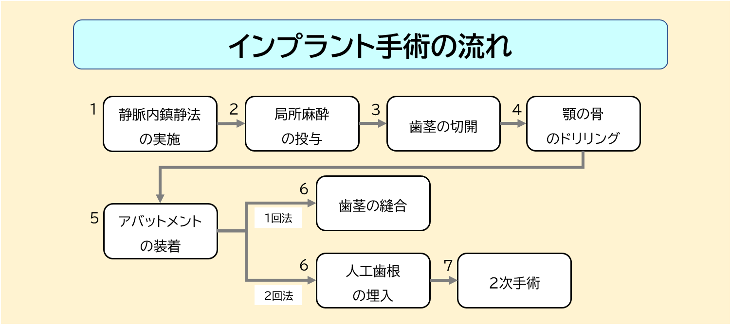 インプラント手術の流れ