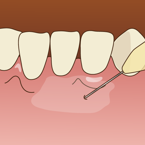 腕のいい歯医者さんなら、痛みの少ない治療ができるの？