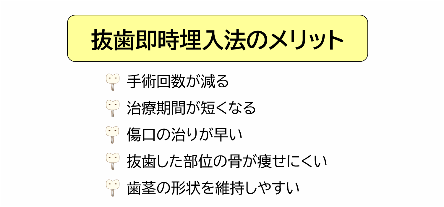 抜歯即時埋入法のメリット