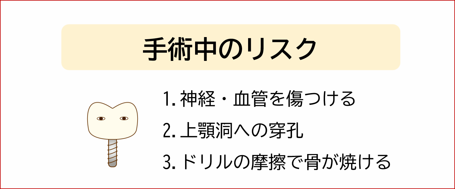 インプラントの手術中のリスク