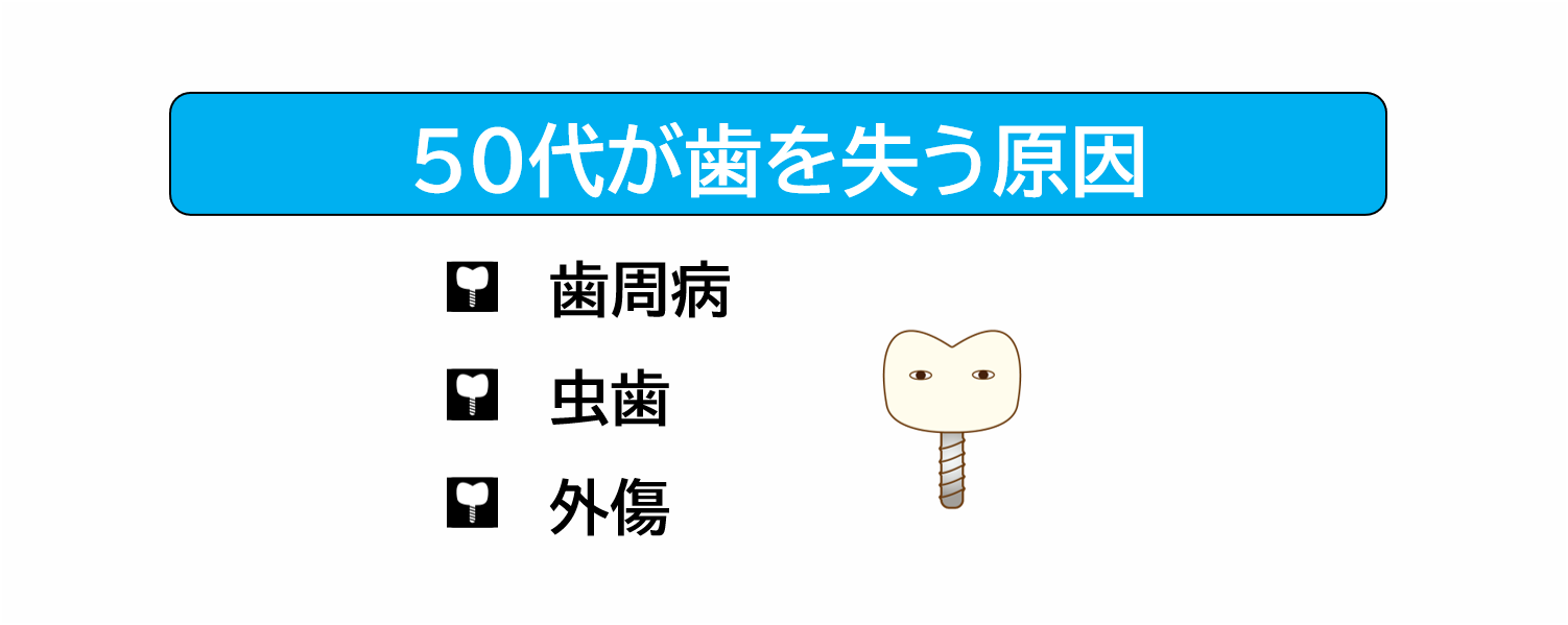 50代が歯を失う原因