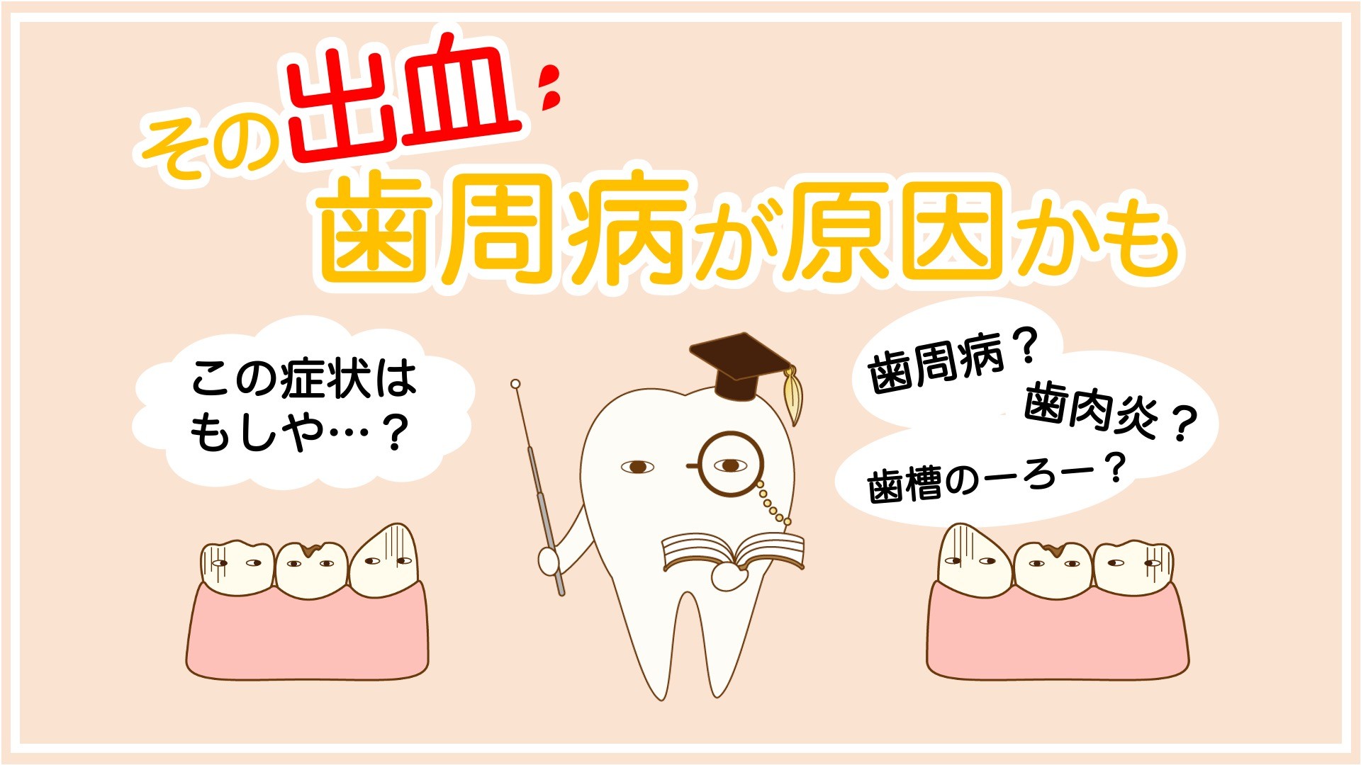歯周病の症状とは？膿や出血は歯周病が原因？