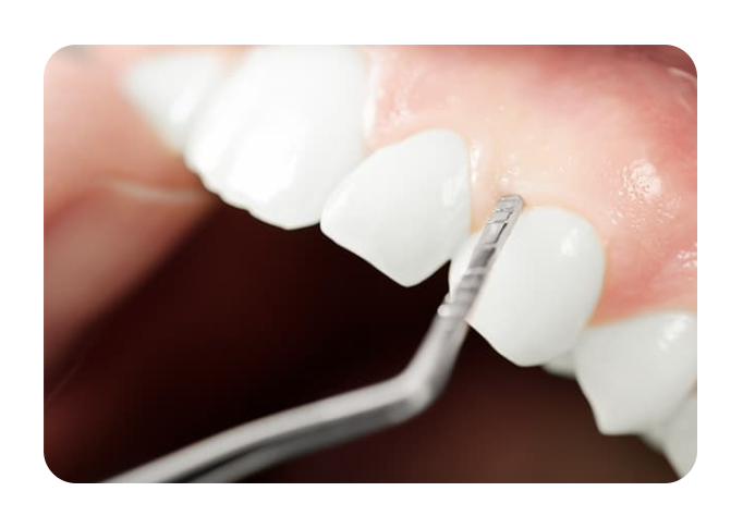 予防歯科のメリットは、全身の健康にも良い影響を与えることです