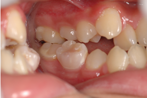 早めの受診をおすすめします