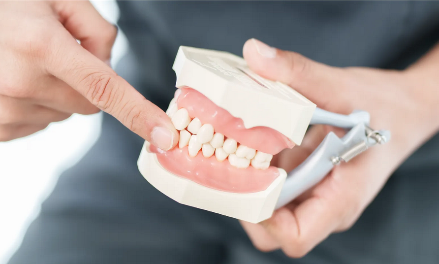 iTeroを使うことで、精度の高いマウスピースが 短期間で仕上がります