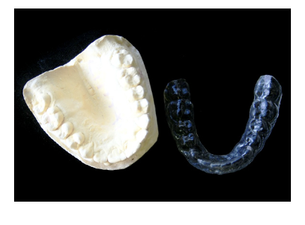 おだ矯正歯科では目立ちにくい矯正装置を幅広く取り揃えています