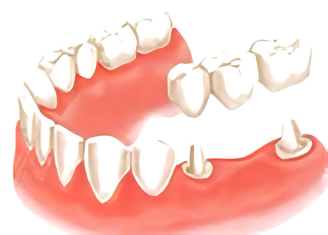 安全性と信頼性を追求したインプラント