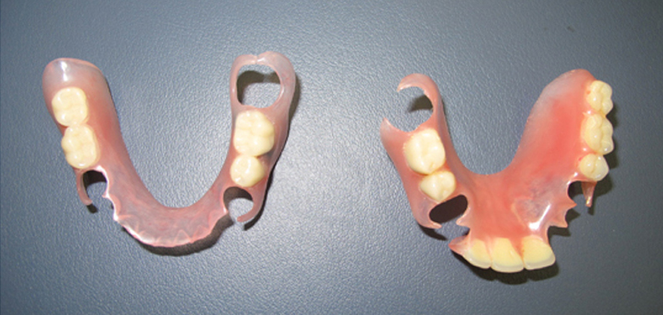 スマートデンチャー