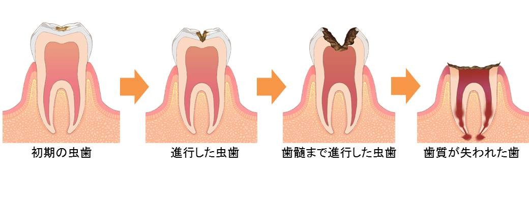 おかしいなと感じたら早めの受診が大切です