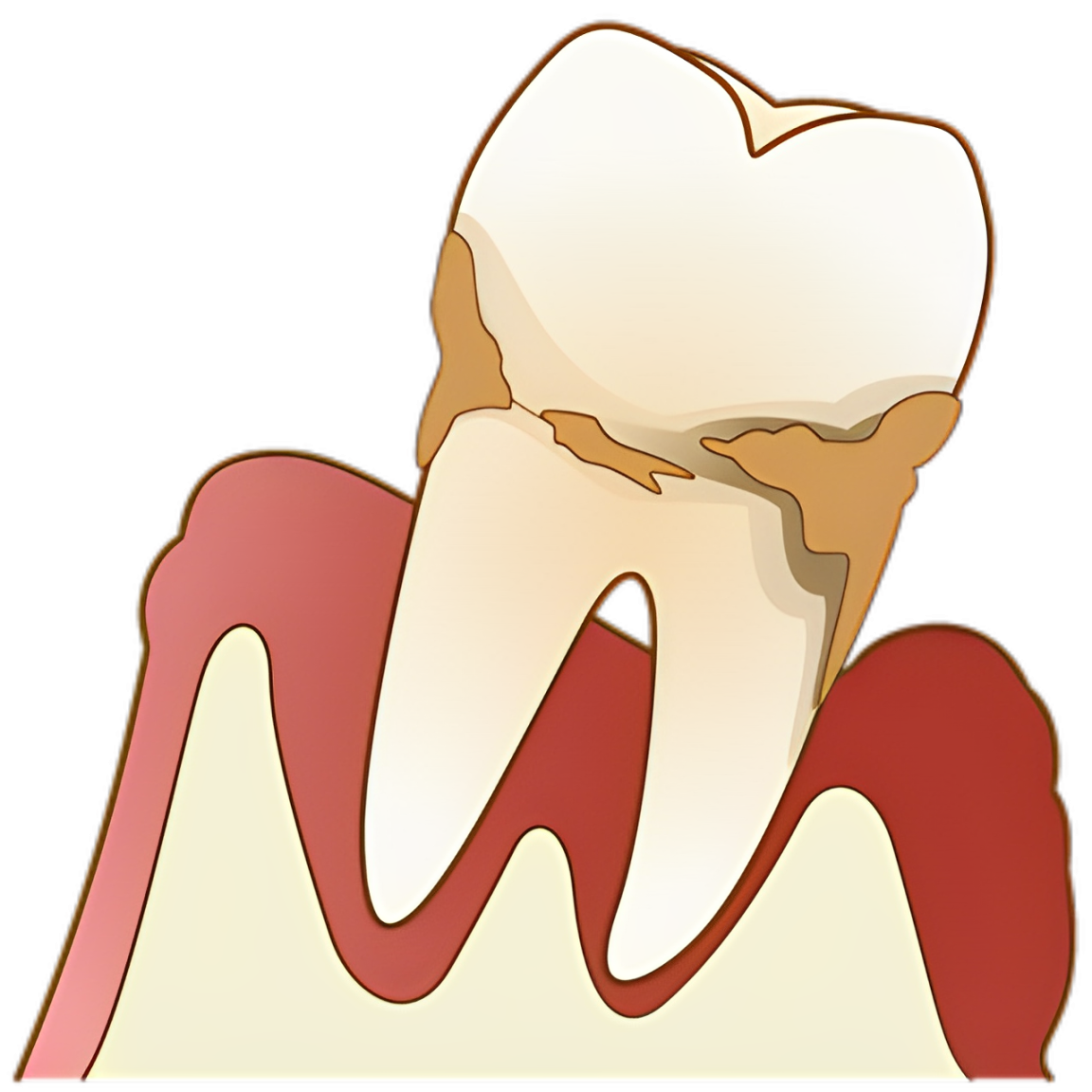 生活習慣の改善や禁煙も大切です