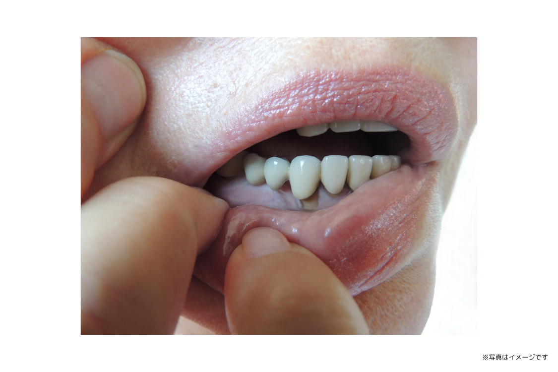 虫歯や歯周病にならないための予防治療に力が注がれています