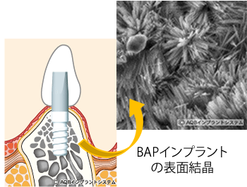 自然な噛み心地と見た目の回復を重視した治療が提供されています