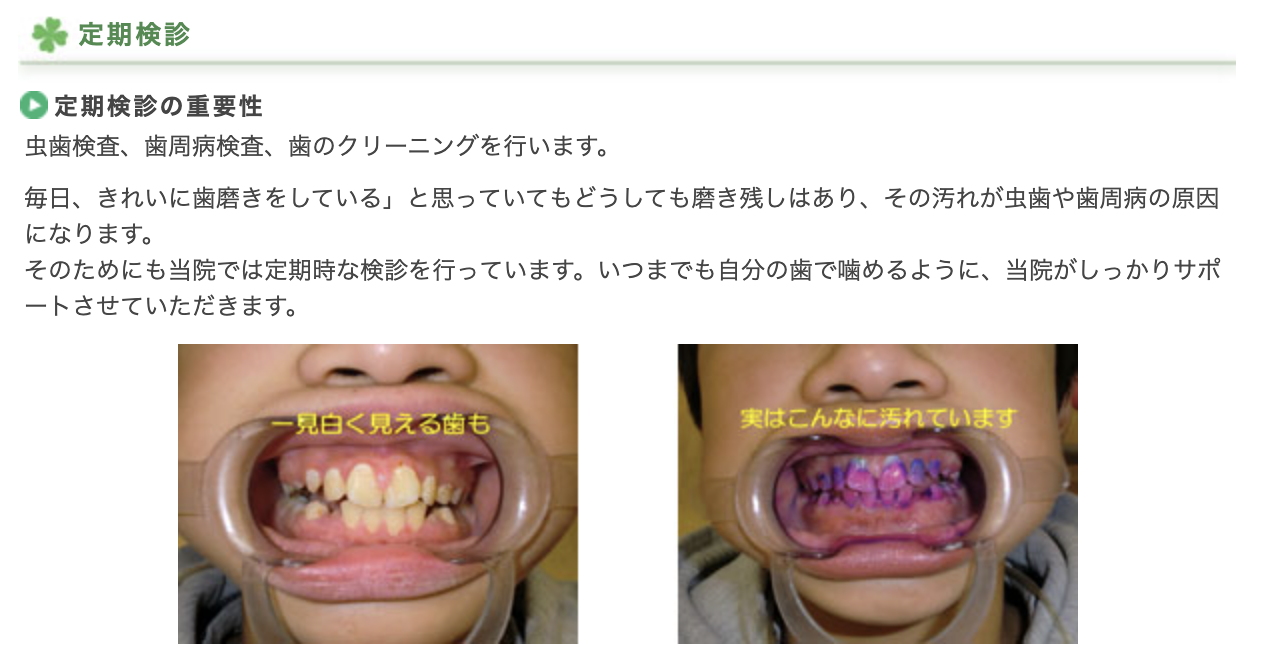 定期検診では、虫歯や歯周病の有無を丁寧にチェックし、必要に応じて適切な処置を行います