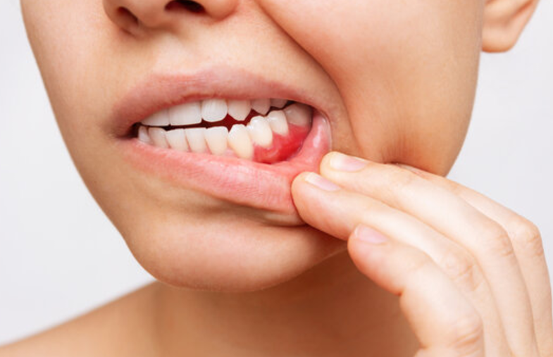 歯周病は全身の疾患にも関係します