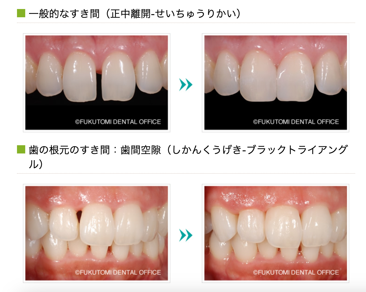 治療の前には、無料カウンセリングと術前シミュレーションを実施し、患者様のご希望や不安をしっかり伺います