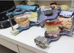 入れ歯の作製は、保険診療と自由診療の2種類からお選びいただけます。