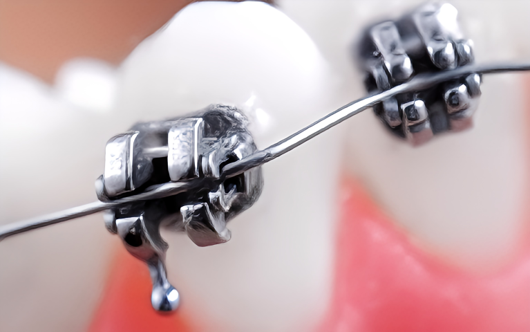 お子様から大人まで安心の矯正診療