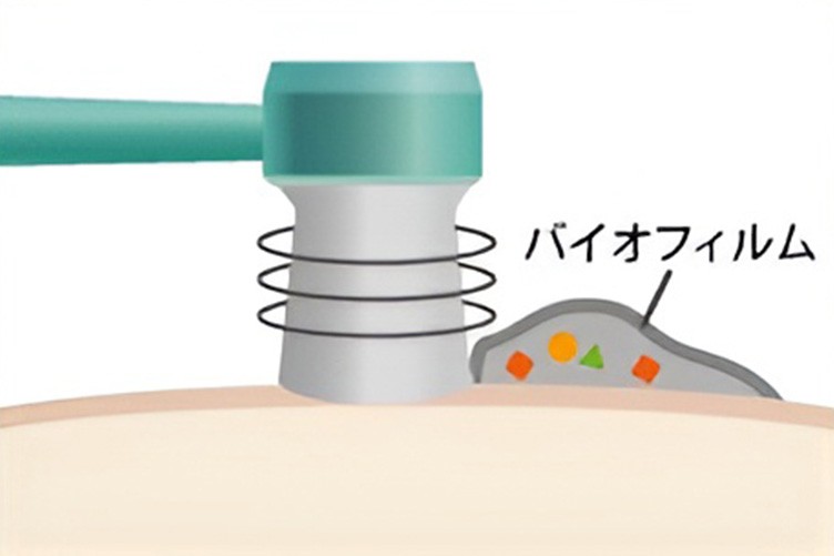 予防歯科は、歯を削らない、抜かない未来を目指すための取り組みです