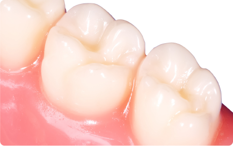 歯周病かもしれないという方も予防したい方もご相談ください