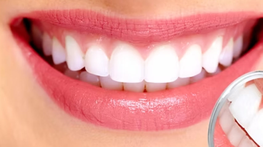 曽根歯科医院の一般歯科治療 患者様に最適な治療を提供