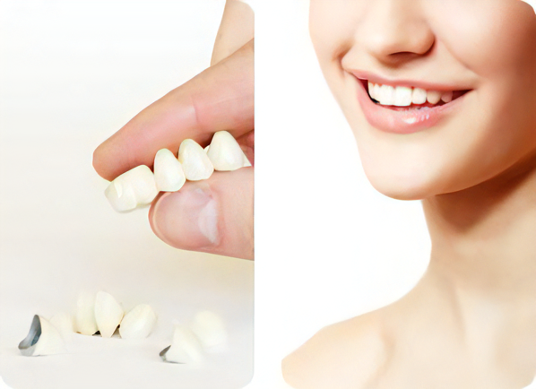 審美歯科治療を提供