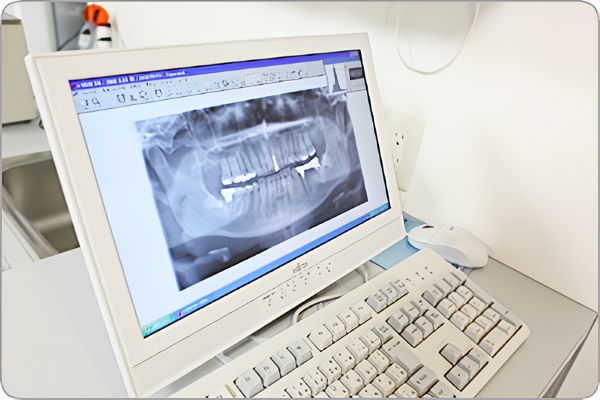 歯周病は自身でのケアが重要になってくるため、生活習慣病であるともいえます