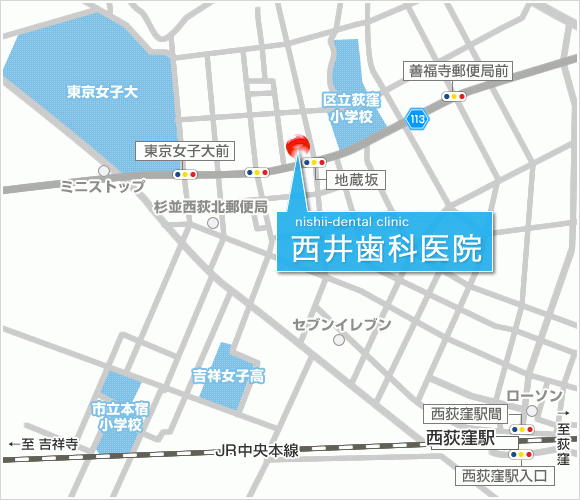 【幼稚園専属医】【最新技術導入】虫歯になるリスクを減らす治療の西井歯科医院