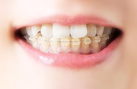 歯や顎への負担を軽減し、より快適で健康的な生活をサポートします。