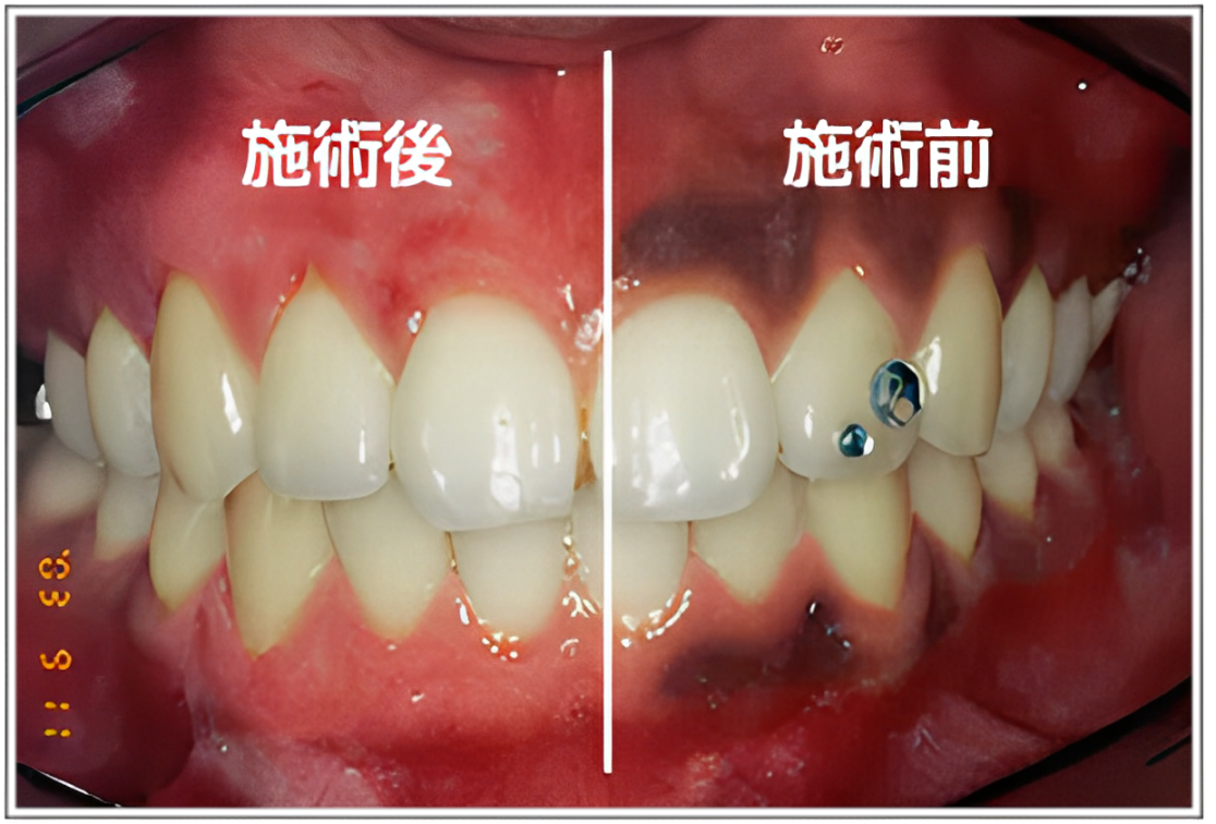 黒ずみが気になる方や口元を美しく整えたい方におすすめ