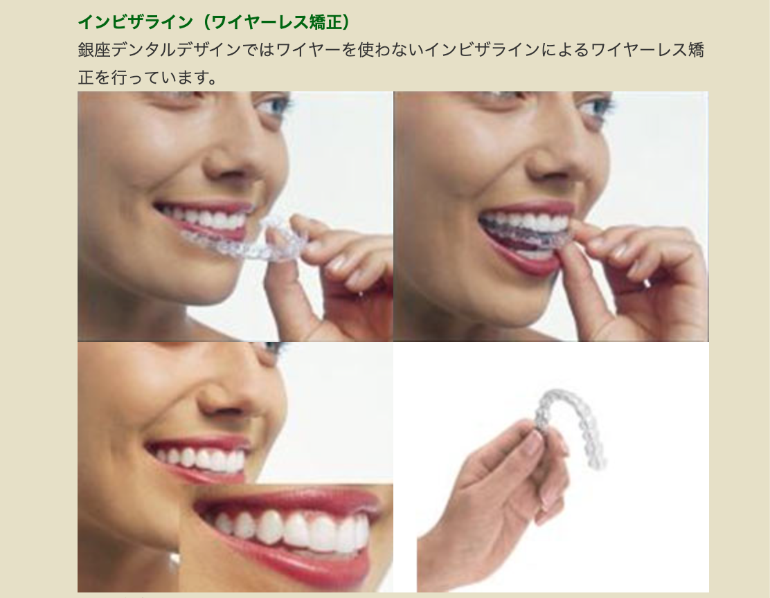 歯並びや噛み合わせを整えることで、美しい口元と健康な機能を実現する治療を提供しています