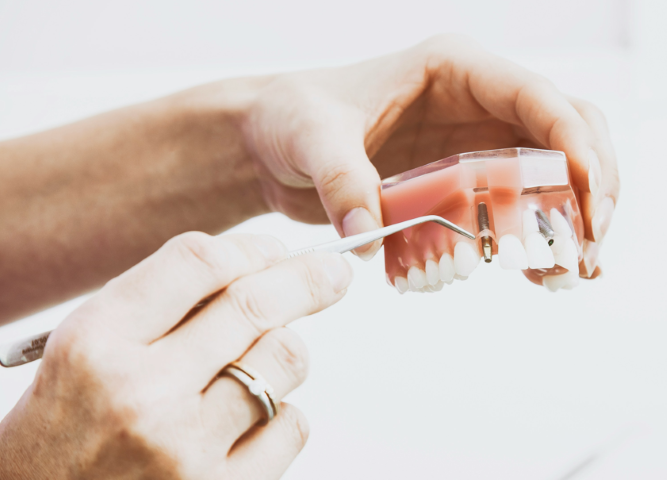 安心と信頼のインプラント治療で、快適な毎日を