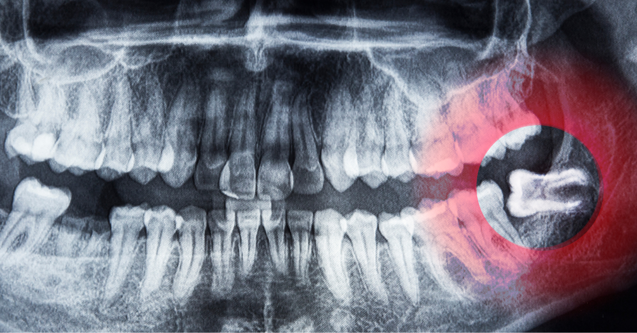 【柴原阪大前駅 徒歩3分・市立豊中病院】「歯科口腔外科」で高度医療と安心の連携体制を提供する「市立豊中病院」