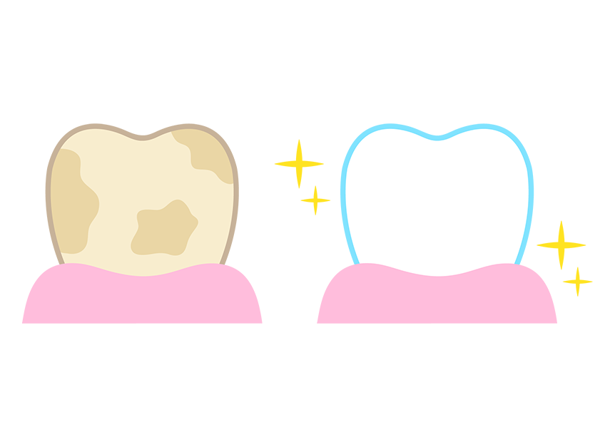 ホームホワイトニングを提供しています。