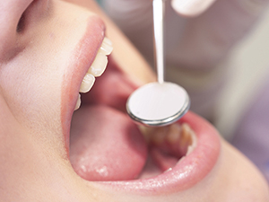 予防歯科に力を入れています