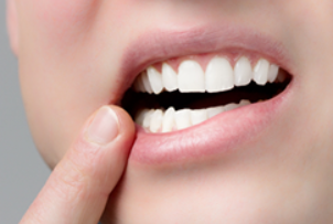 顎に違和感がある場合は、顎関節症かもしれません