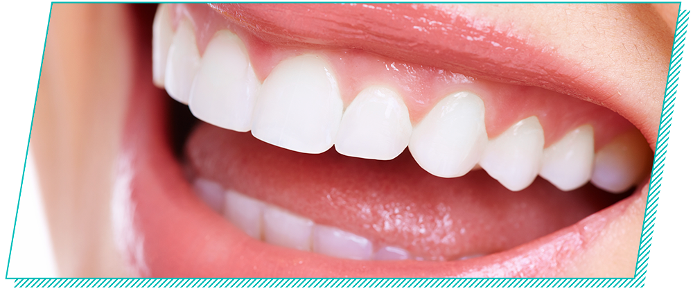 ライフスタイルに合わせた白さ