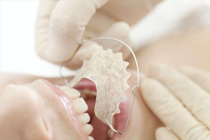 歯並びや噛み合わせに関する悩みに応じて、床矯正、マウスピース矯正、ワイヤー矯正を提案しています。