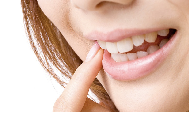 ホワイトニングは、歯を漂白して白くする治療法です