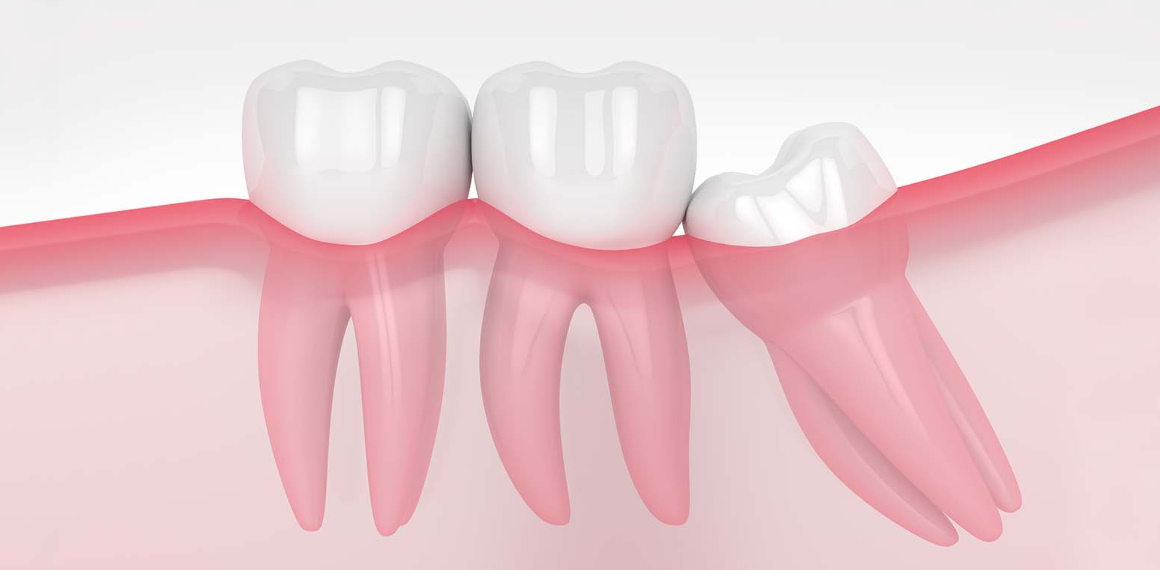 口腔外科領域もお任せください