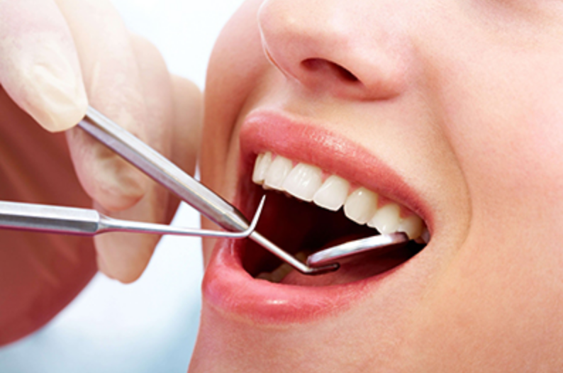 定期的に歯科検診で、虫歯や歯周病を予防